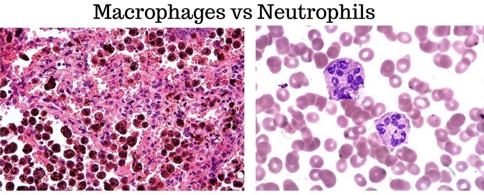 Macrophages vs Neutrophils