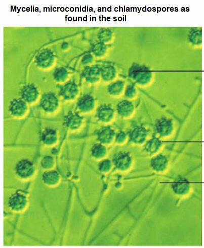 Mycelia, microconidia, and chlamydospores as found in the soil