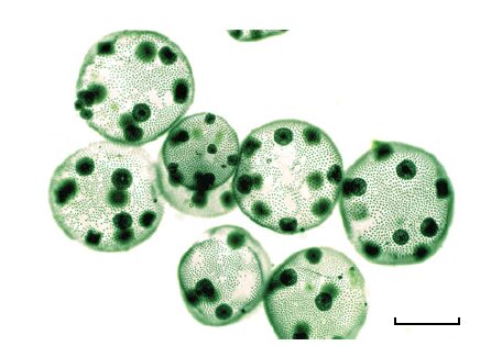 A light microscope image of the colonial green alga Volvox