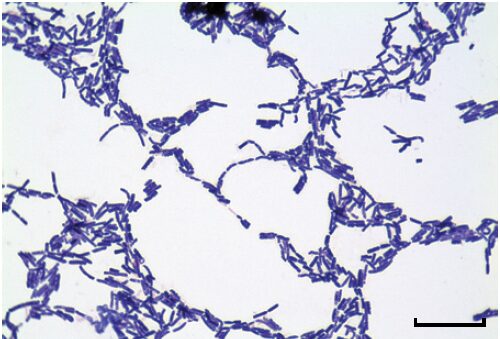 Rod-shaped cells of Bacillus cereus