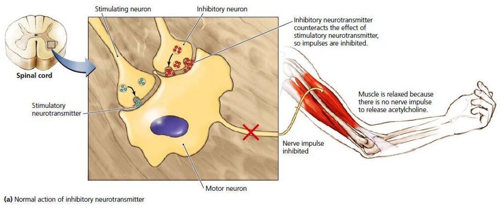 Tetanus Etiology Pathogenesis And Treatment Microbiology Notes