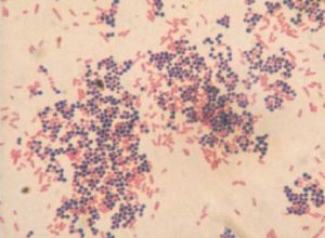 Gram Staining - Gram positive bacteria are purple in colour whereas gram negative bacteria are pink