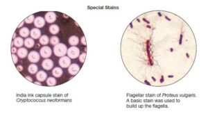 Capsule Staining and Flagella Staining