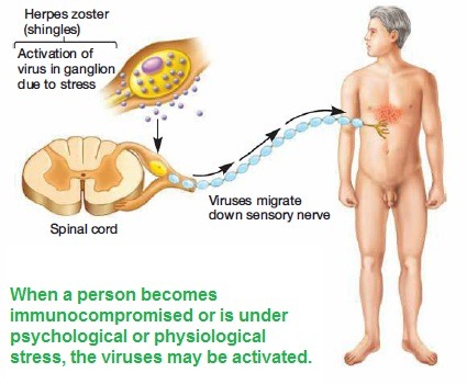 When a person becomes immunocompromised or is under