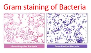 Procedures of Gram staining - Microbiology Notes