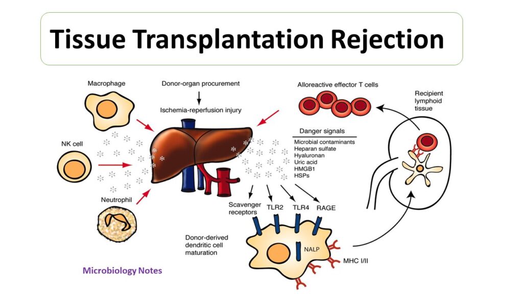 mechanism-of-cellular-rejection-in-transplantation-microbiology-notes