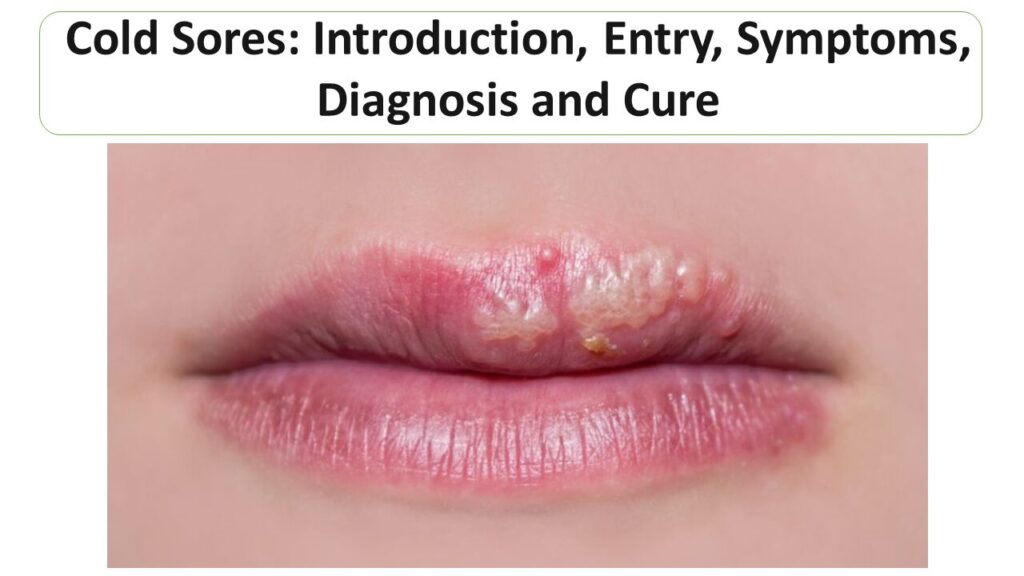 medical-microbiology-microbiology-notes