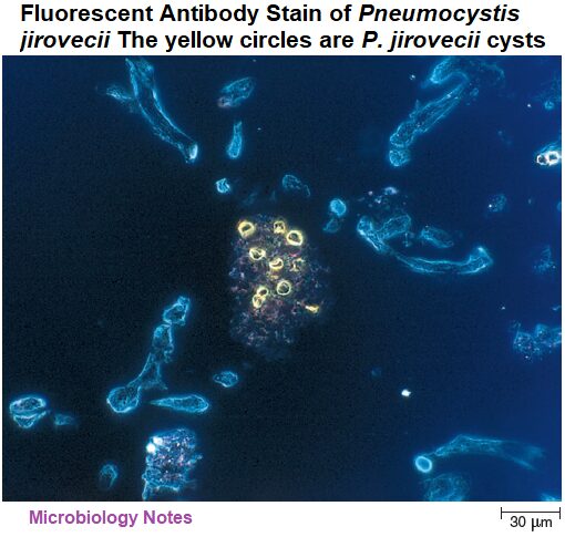 Fluorescent Antibody Stain of Pneumocystis jirovecii, The yellow circles are P. jirovecii cysts,