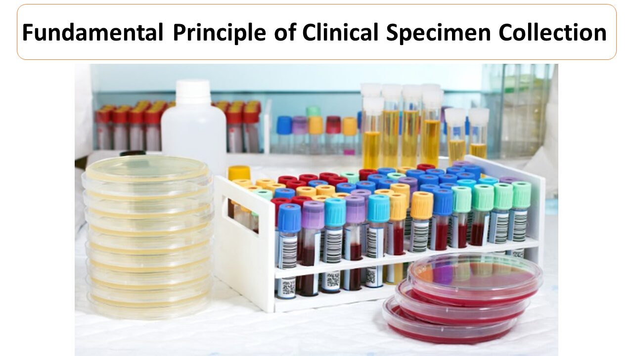 fundamental-principle-of-clinical-specimen-collection-microbiology-notes