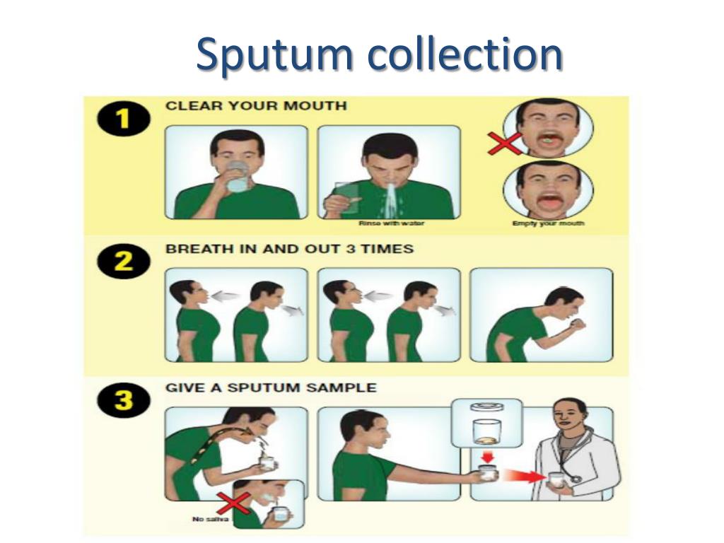 Collection of sputum sample