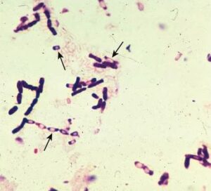 Clostridium