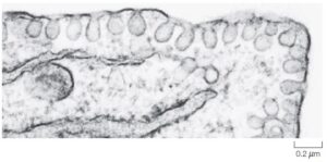 Electron Microscopic image- Caveolae