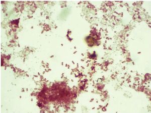 Gram Staining of the Salmonella Typhi from positive blood sample