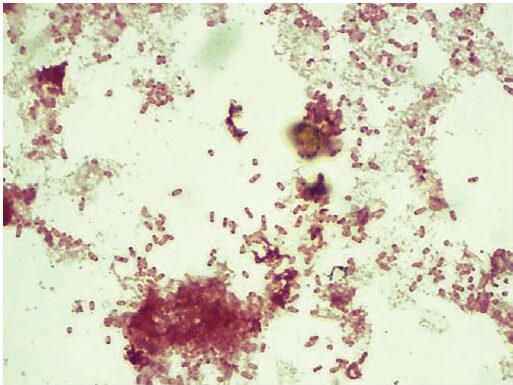 Salmonella Epidemiology Pathogenesis Diseases And Treatment