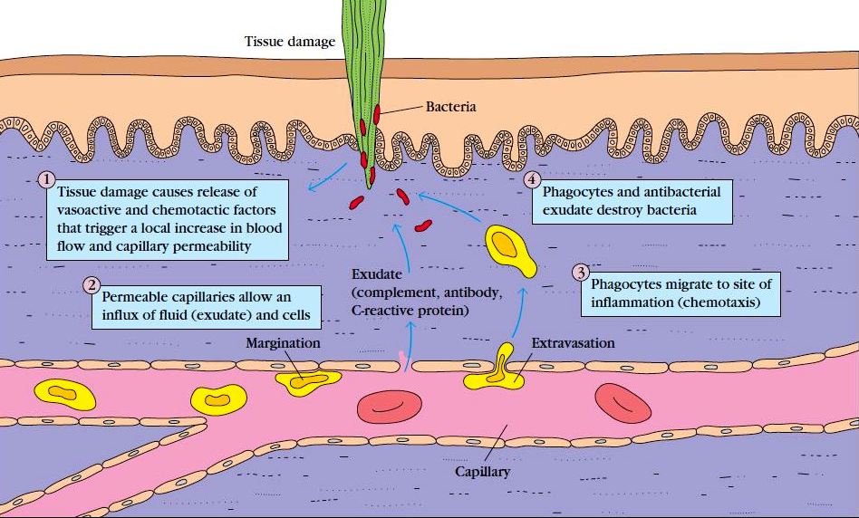 Inflammation-Process, Factors, and Anti-Inflammatory agents