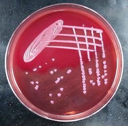 E.Coli on MacConkey agar