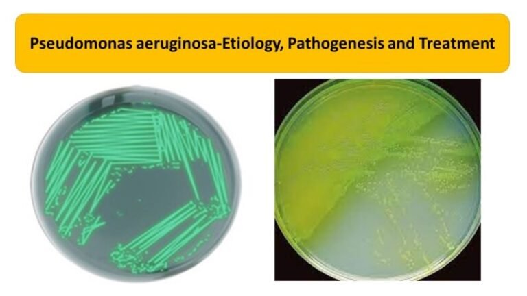 Pseudomonas aeruginosa-Etiology, Pathogenesis and Treatment
