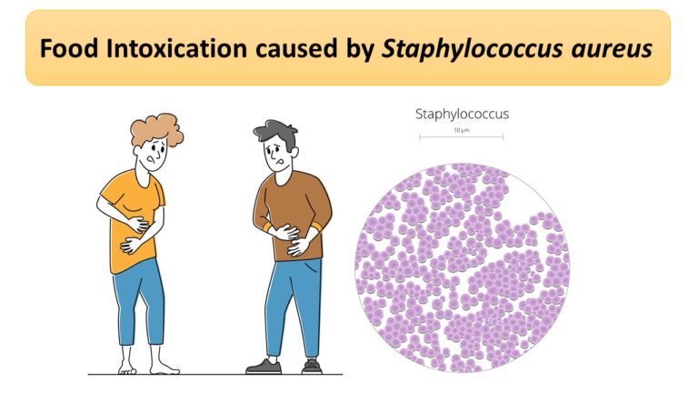 Food Intoxication caused by Staphylococcus aureus
