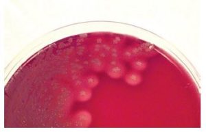 S. aureus colonies on the blood agar