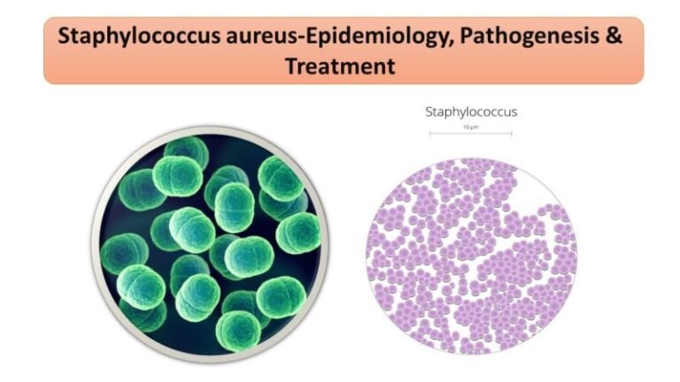 Staphylococcus aureus-Epidemiology, Pathogenesis & Treatment