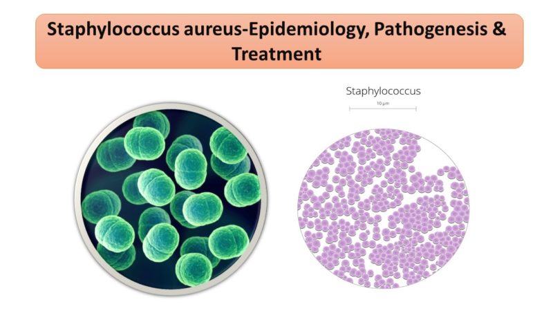 Molecular Pathogenesis of Staphylococcus aureus Infection