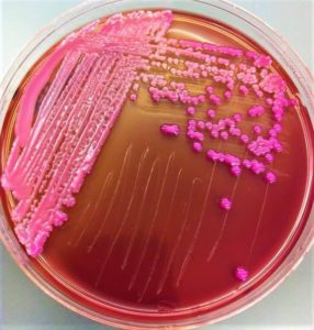 Klebsiella on MacConkey agar