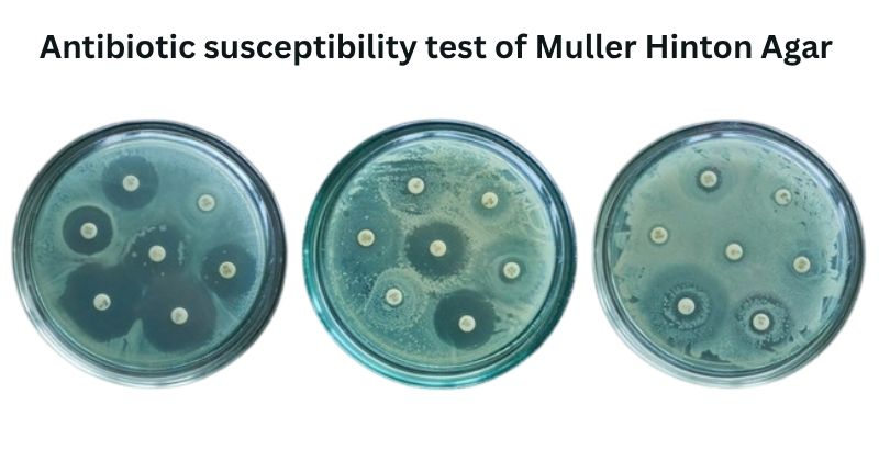 Antibiotic susceptibility test of Muller Hinton Agar