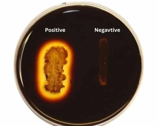 Positive & Negative results of starch hydrolysis test