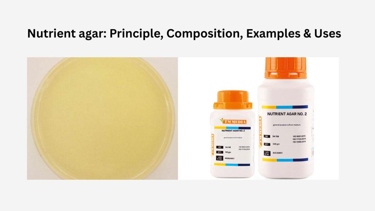 Nutrient agar