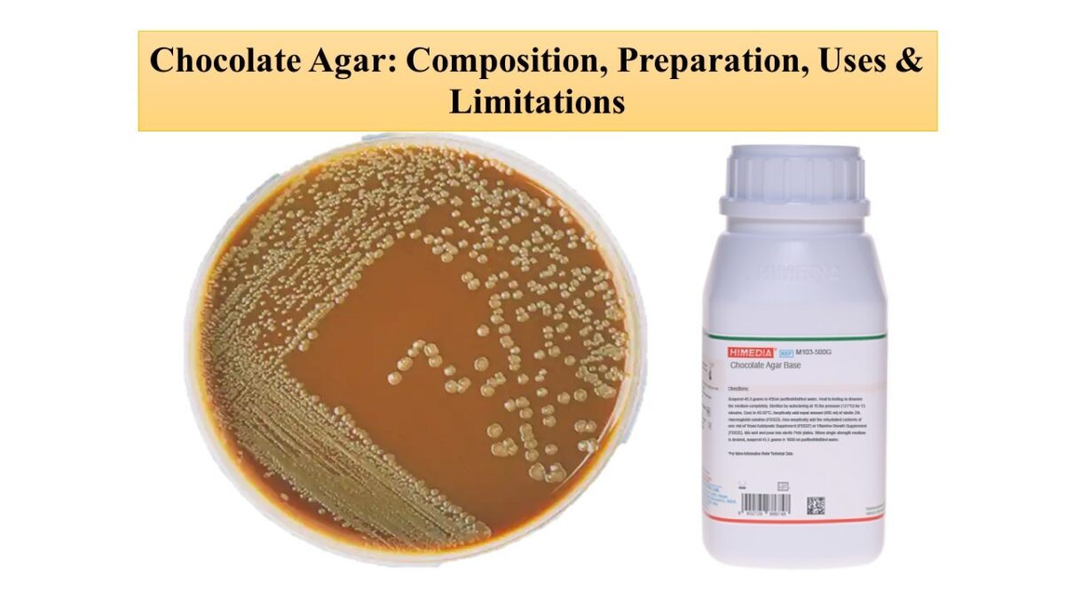 Chocolate Agar