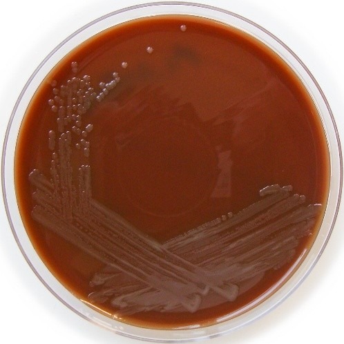 Neisseria meningitidis colonies growing on chocolate agar