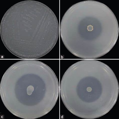 Some bacteria showing halo zone around colonies to showing Aleksandrow agar activity