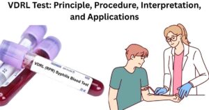 VDRL Test: Principle, Procedure, Interpretation, and Applications