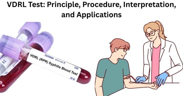 VDRL Test: Principle, Procedure, Interpretation, and Applications