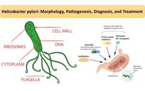 Helicobacter pylori: Morphology, Pathogenesis, Diagnosis, and Treatment